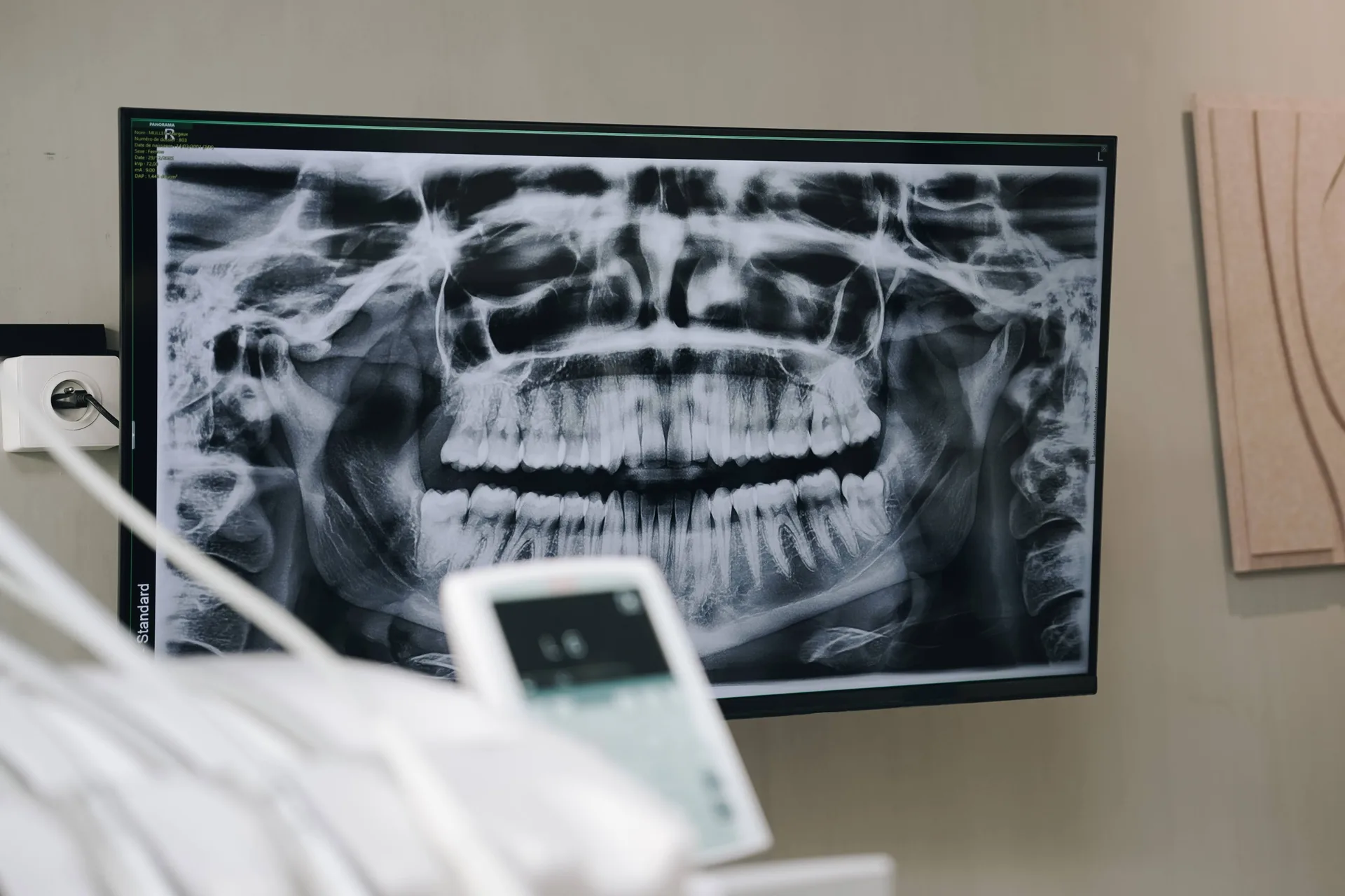 Radio panoramique numérique – Cabinet Todea